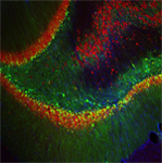 FGF9 Neurons